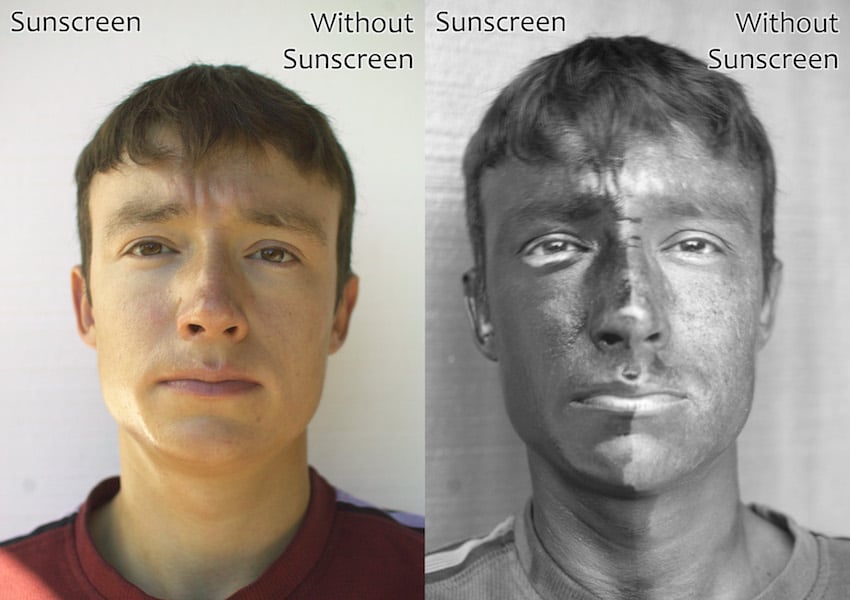 example of sun damage that is visible