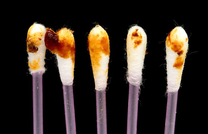 7-signs-of-health-issues-your-earwax-could-reveal