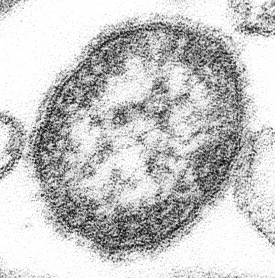 measle virus 