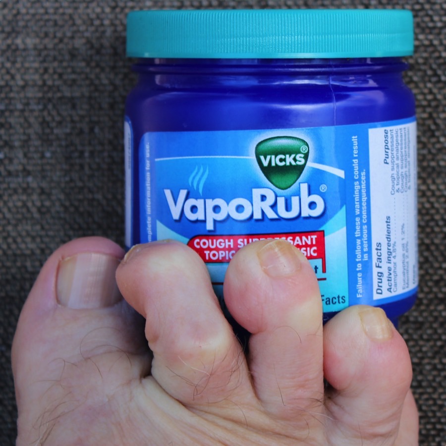 Vicks VapoRub for Cracked Heels