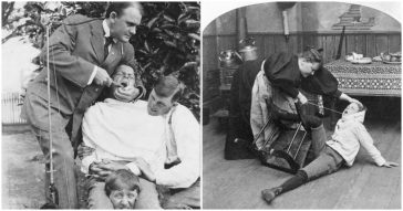 30 Weird And Disgusting Dental Practices From History