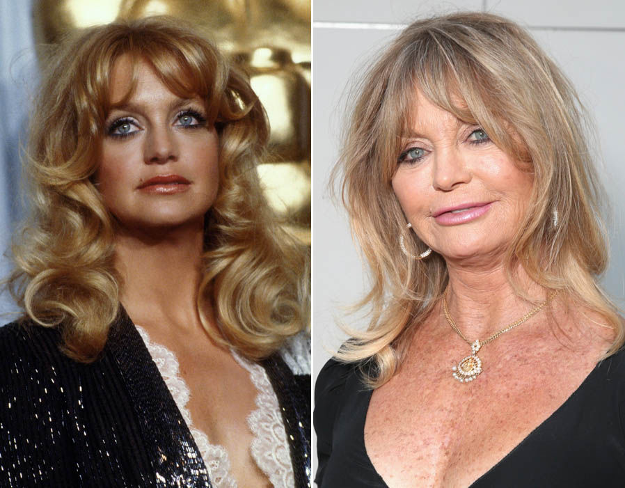 50 Fabulous Stars From The 70s Then And Now | DoYouRemember?
