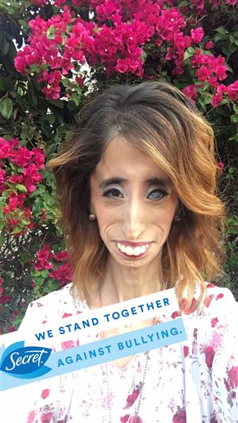 Once Called The Worlds Ugliest Woman 25 Years Later Lizzie Velasquez Becomes Anti Bullying