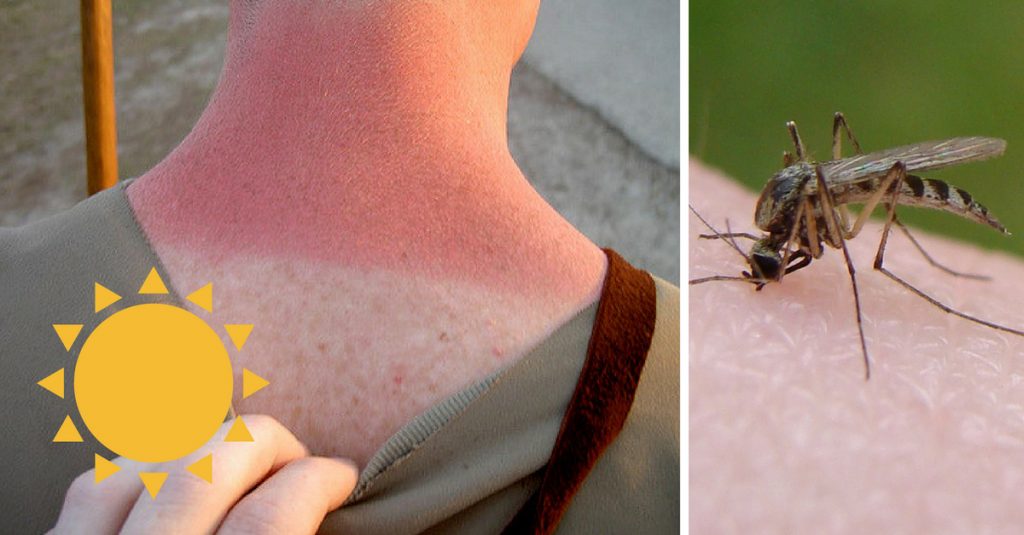 Best Ways To Treat Sunburns, Bug Bites, Heat Stroke And Other Ailments