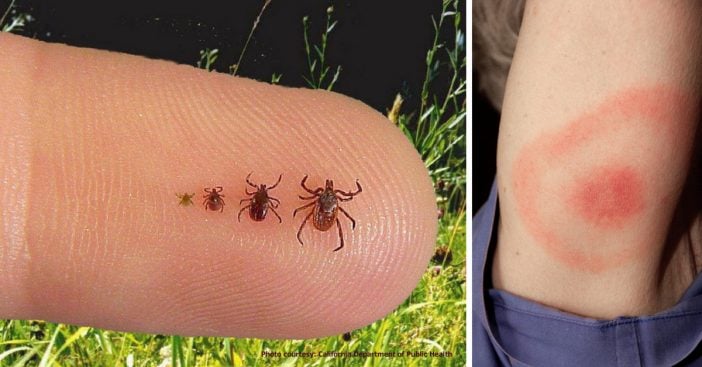 lyme-disease-ticks