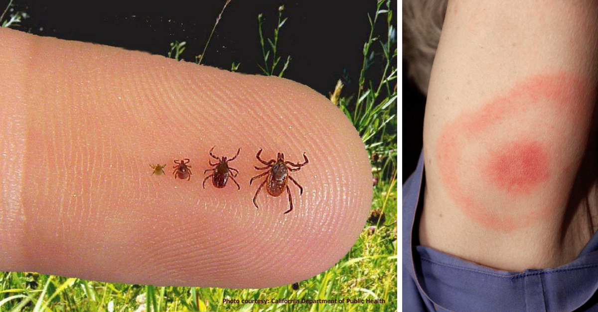 PSA: Diseases From Mosquitoes, Ticks, And Fleas Are On The Rise