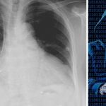 pacemaker-hacked