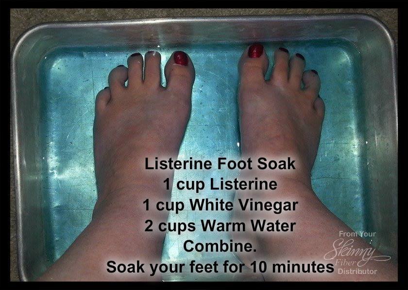 listerine foot soak
