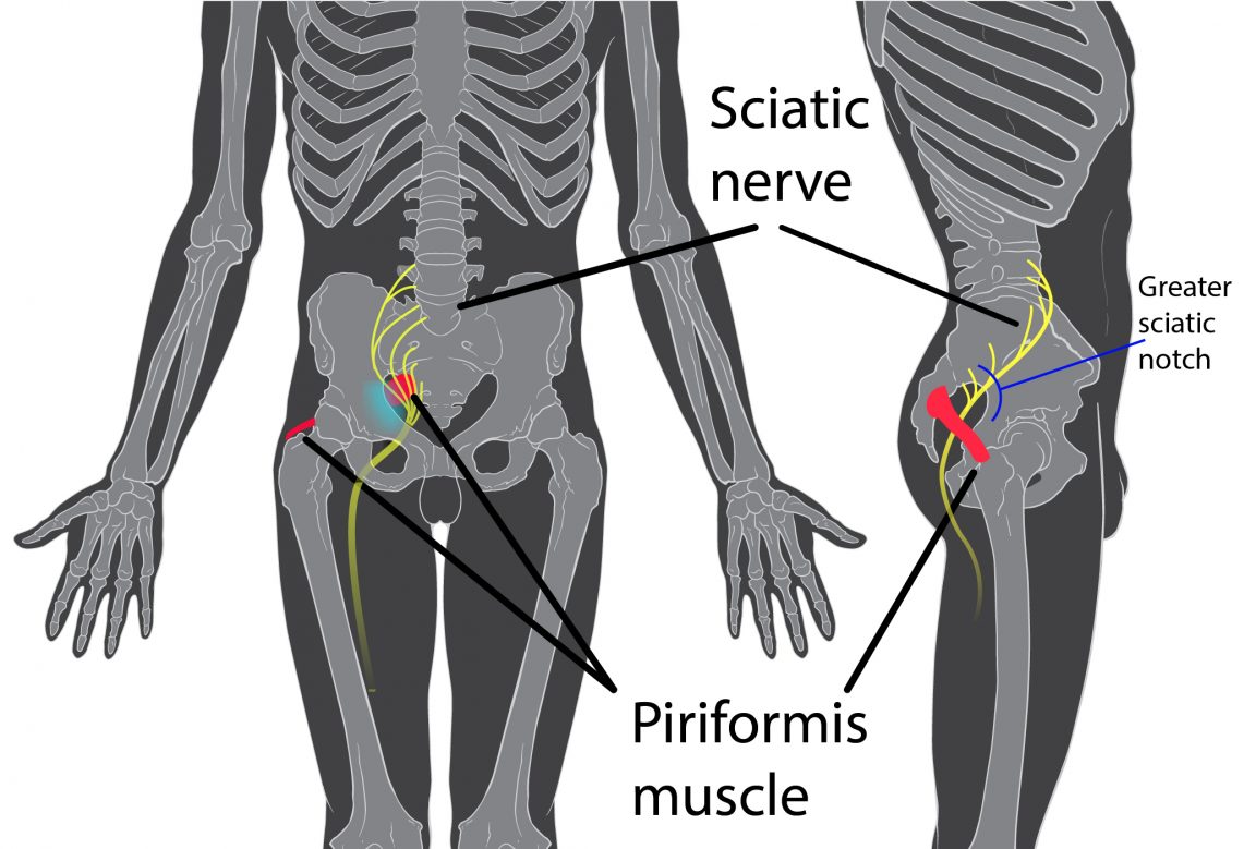 Have Sciatic Nerve Pain? Try This Super Easy Remedy To Get Rid Of It