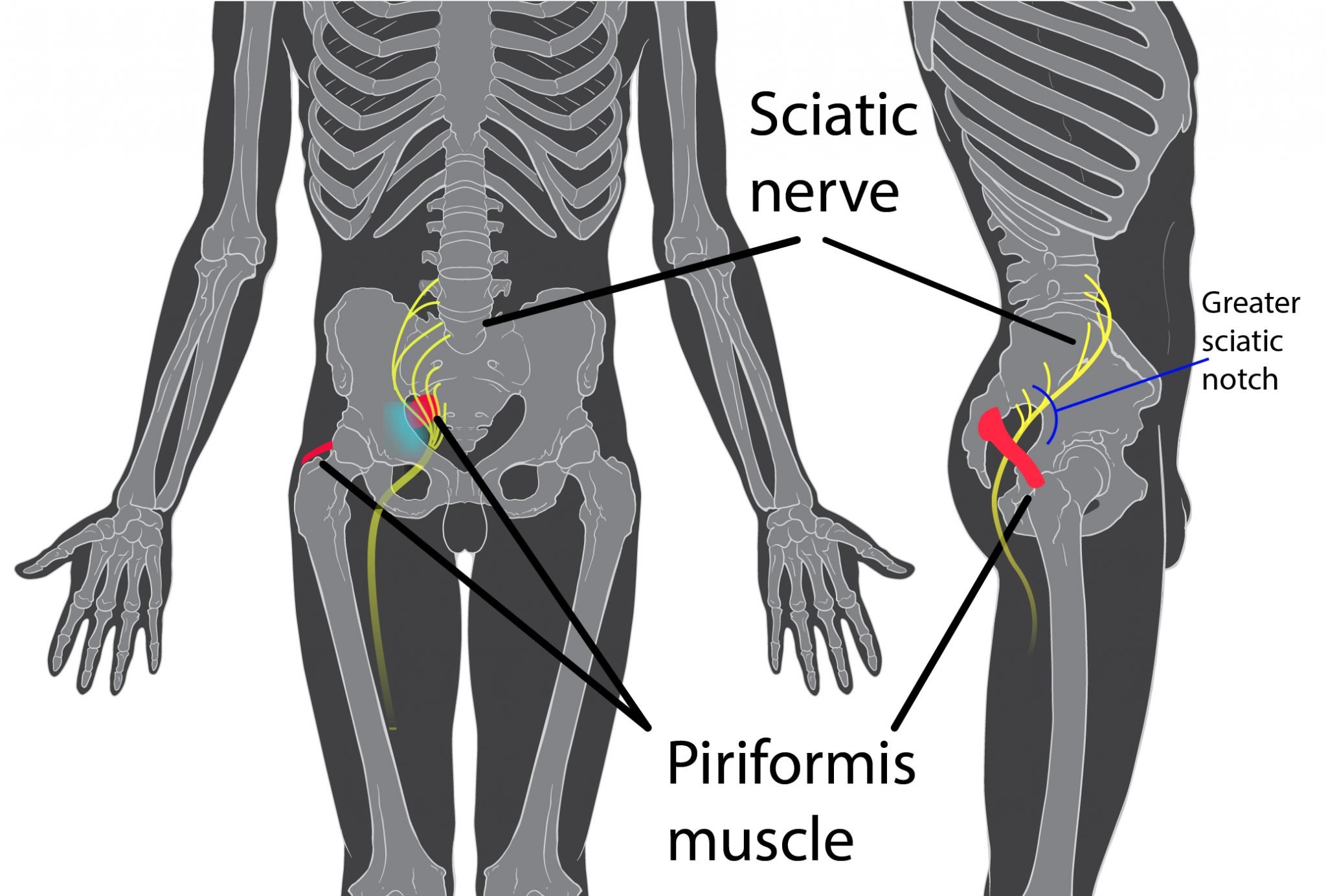 r sciatic nerve pain icd 10