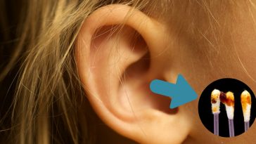 earwax-cover