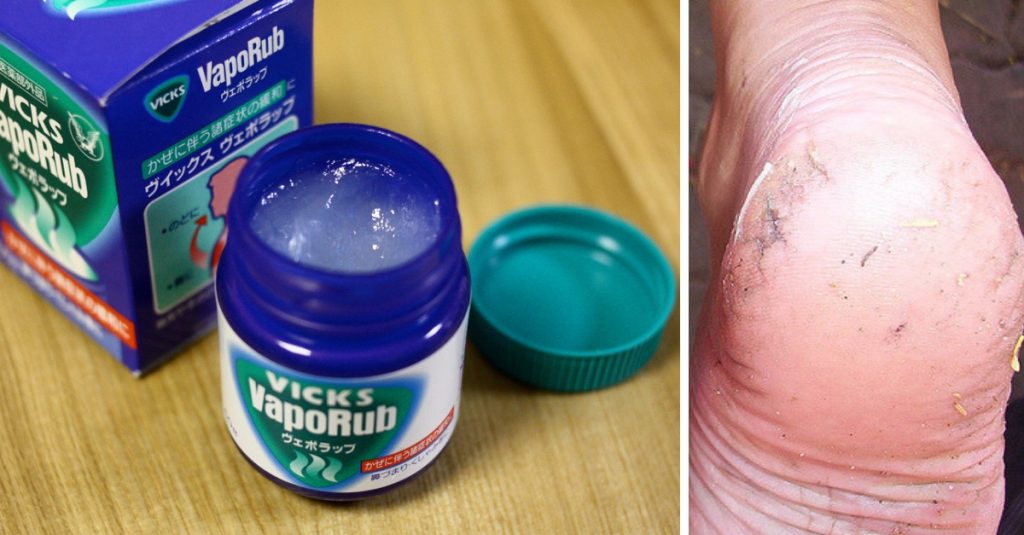 13 Amazing And Unlikely Uses For Vick's VapoRub