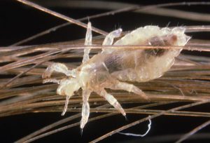 Mom's Home Remedy For Head Lice — Have You Tried It?