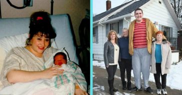 man born with rapid growth condition defying all health odds