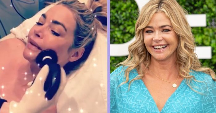 denise richards defends non-invasive cosmetic procedure