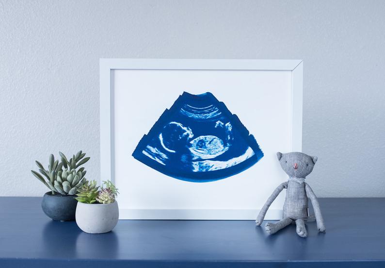 Etsy ultrasound watercolor print