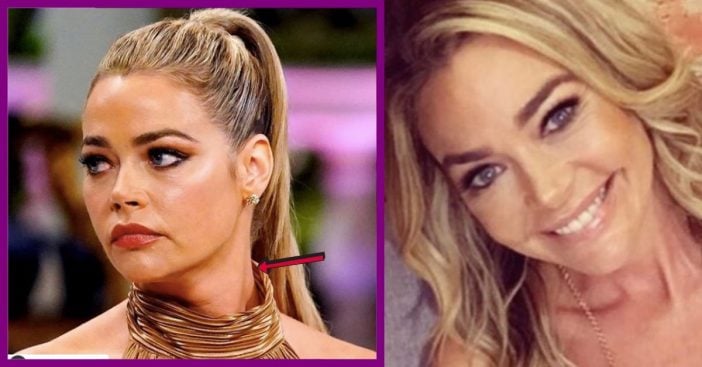 Denise Richards Changes Diet After Fans Notice Enlarged Thyroid