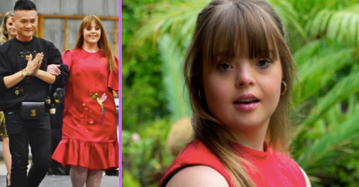 Model With Down Syndrome Katie Harris Gets To Walk The Catwalk 3894