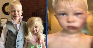 6-year-old boy saves sister from dog attack