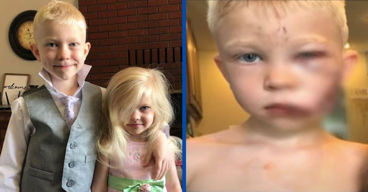 6-year-old boy saves sister from dog attack