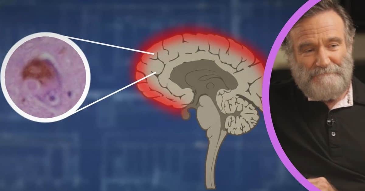 Understanding Lewy Body Dementia, "The Terrorist Inside" Robin Williams