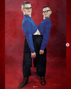Conjoined twins Ronnie and Donnie Galyon