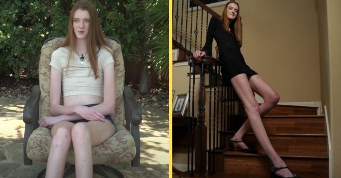 texas teen wins guinness world record for longest legs