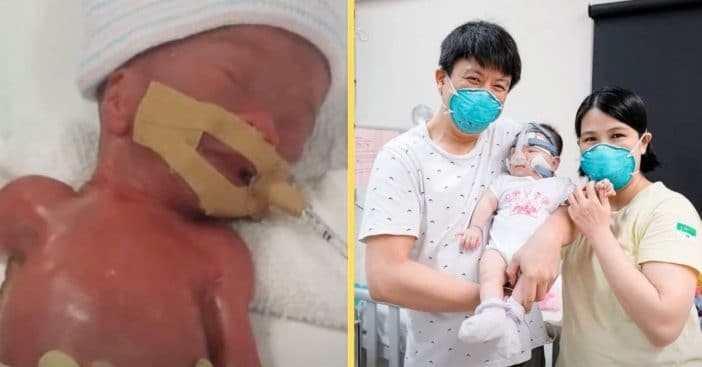 The 'Smallest Baby At Birth' Is Finally Home After 13 Months In The Hospital