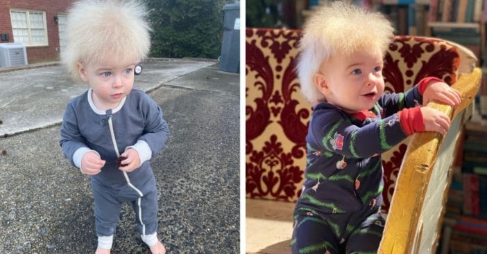 Young Boy With Uncombable Hair Syndrome Is Cutest Thing On The Internet Today
