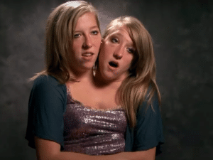 A Reddit post claims that conjoined twins Brittany and Abby Hensel are married