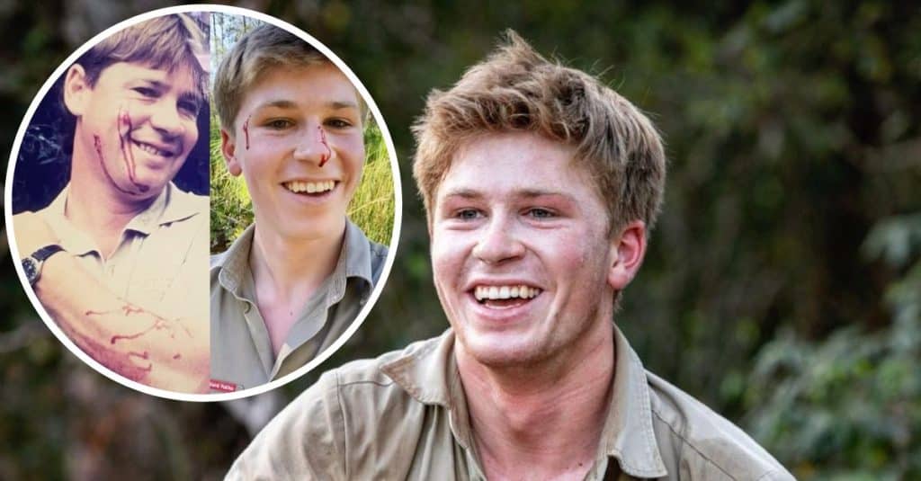 Robert Irwin Has LookAlike Moment With Dad Steve After Getting Bitten(00)