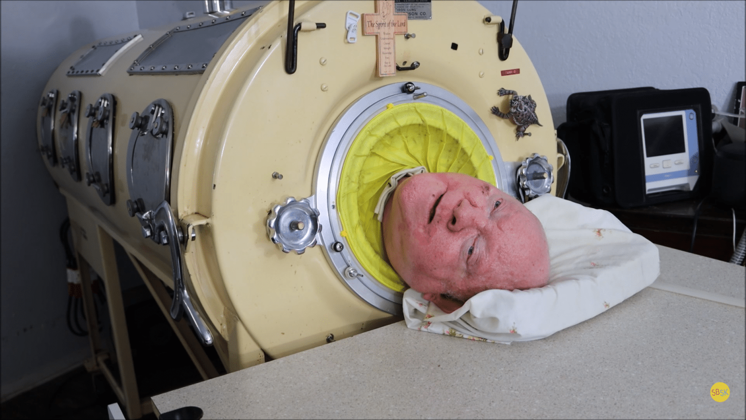 Paul Alexander 'Polio Paul' Who Lived In Iron Lung For 70 Years, Dies At 78