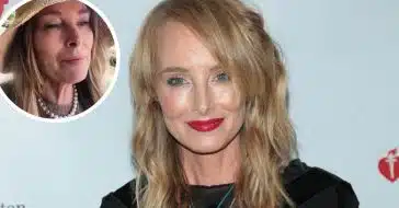 Chynna Phillips gets candid about her surgery fears and frustrations
