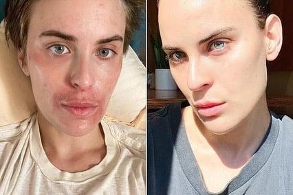 Tallulah Willis health disorder