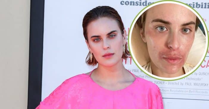 Tallulah Willis health disorder