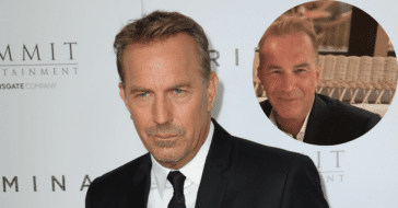 Kevin Costner Plastic surgery