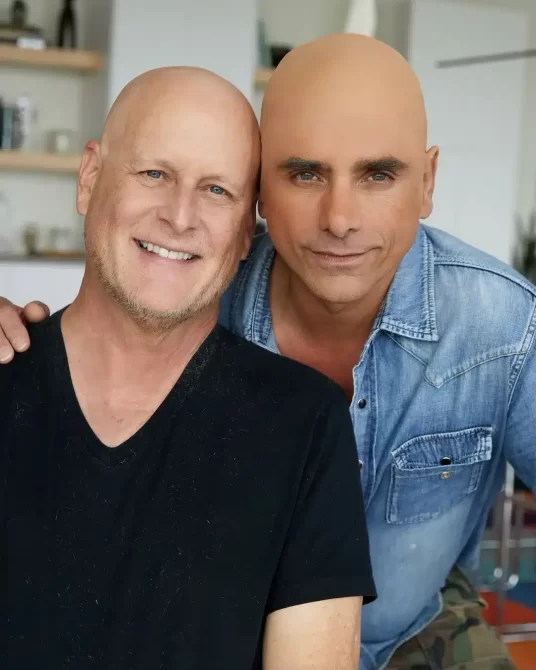 john stamos bald cap