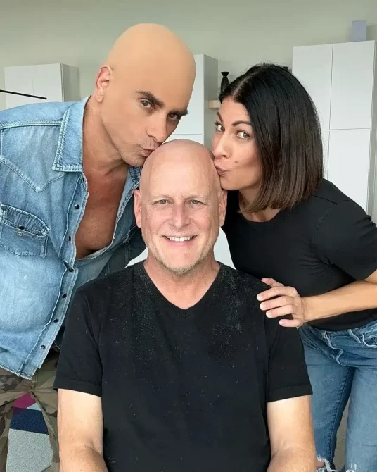 john stamos bald cap