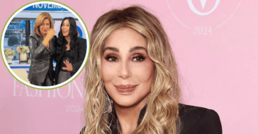 Cher plastic surgery