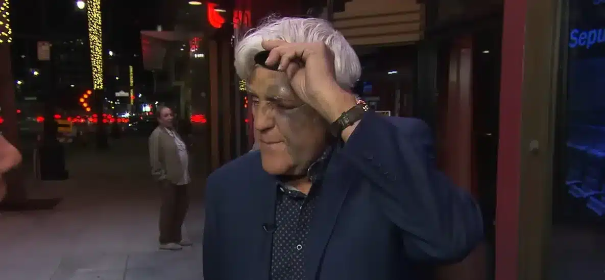 Jay Leno hits head on rock