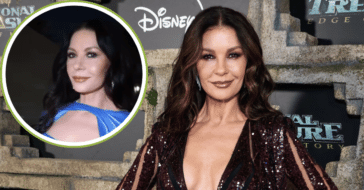 Catherine zeta-jones botox