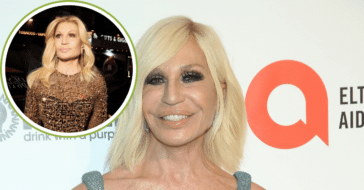 Donatella Versace plastic surgery