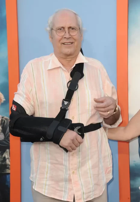 Fans Are Concerned After Chevy Chase Is Seen Sporting Nasty Black Eye