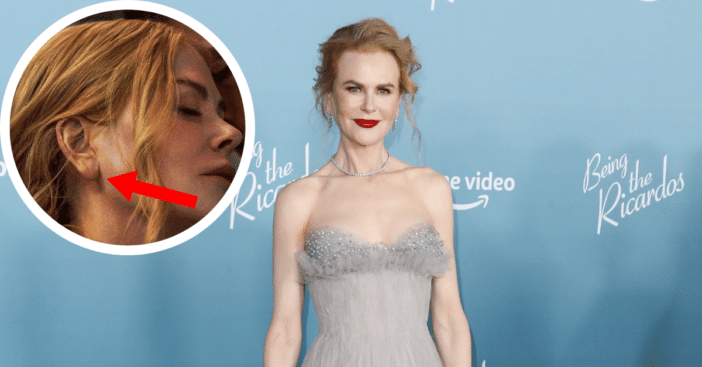 Nicole Kidman stretched ears