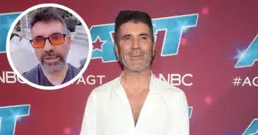 Simon Cowell altered appearance