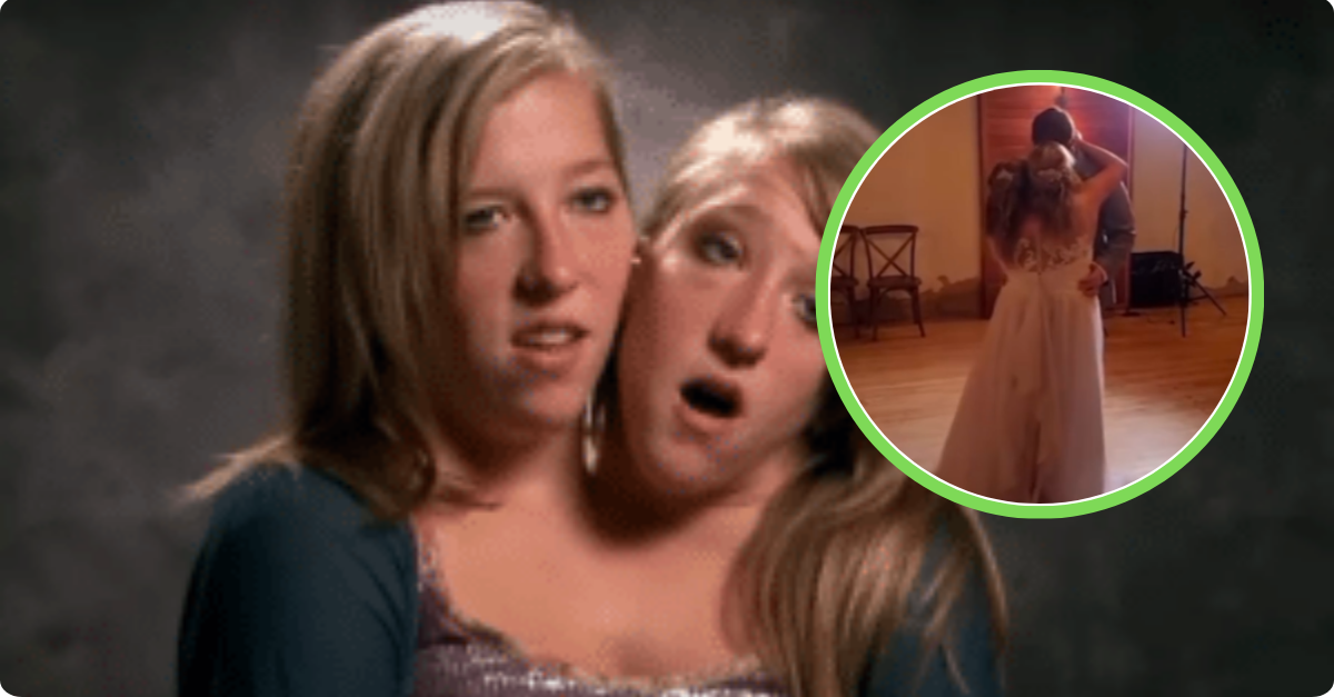 Abby and Brittany Hensel Spotted With Newborn Baby