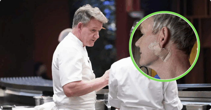 Gordon Ramsay skin cancer
